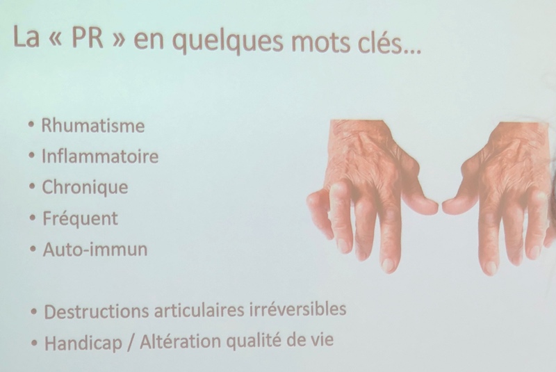 POLYARTHRITE RHUMATOÏDE, INVISIBLE MAIS BIEN RÉELLE